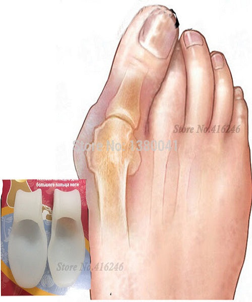 Anatomski Štitnik Za Čukljeve Hallux Valgus - Anatomski Štitnik Za Čukljeve Hallux Valgus